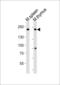 Terminal Uridylyl Transferase 4 antibody, MBS9214563, MyBioSource, Western Blot image 
