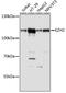 Enhancer Of Zeste 2 Polycomb Repressive Complex 2 Subunit antibody, 16-772, ProSci, Western Blot image 