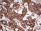 Nudix Hydrolase 12 antibody, M13426, Boster Biological Technology, Immunohistochemistry paraffin image 