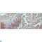 RB Transcriptional Corepressor 1 antibody, LS-C812758, Lifespan Biosciences, Immunohistochemistry paraffin image 