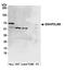 PDZ And LIM Domain 5 antibody, A301-704A, Bethyl Labs, Western Blot image 