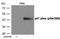 Neutrophil Cytosolic Factor 1 antibody, GTX55429, GeneTex, Western Blot image 