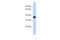 Nudix Hydrolase 18 antibody, 26-360, ProSci, Western Blot image 