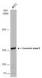 Laminin Subunit Beta 3 antibody, GTX110583, GeneTex, Western Blot image 