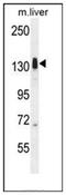 Lemur Tyrosine Kinase 3 antibody, AP52509PU-N, Origene, Western Blot image 