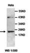 Zinc Finger C4H2-Type Containing antibody, orb77700, Biorbyt, Western Blot image 