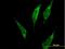 Phenylalanine--tRNA ligase alpha chain antibody, H00002193-B01P, Novus Biologicals, Immunofluorescence image 