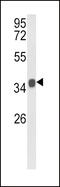 Kruppel Like Factor 6 antibody, 62-347, ProSci, Western Blot image 