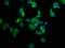 Lysosomal Protein Transmembrane 4 Alpha antibody, LS-C671738, Lifespan Biosciences, Immunofluorescence image 