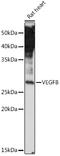 Vascular Endothelial Growth Factor B antibody, GTX16404, GeneTex, Western Blot image 