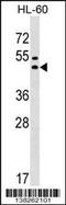 G Protein-Coupled Receptor 20 antibody, 59-562, ProSci, Western Blot image 