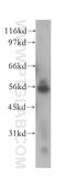 NIMA Related Kinase 11 antibody, 12710-1-AP, Proteintech Group, Western Blot image 