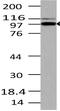 TLR4 Interactor With Leucine Rich Repeats antibody, A09398, Boster Biological Technology, Western Blot image 