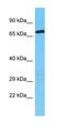 RFX Family Member 8, Lacking RFX DNA Binding Domain antibody, orb327180, Biorbyt, Western Blot image 