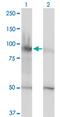Helicase, Lymphoid Specific antibody, MA5-19067, Invitrogen Antibodies, Western Blot image 