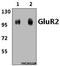 Glutamate Ionotropic Receptor AMPA Type Subunit 2 antibody, A02905Y873, Boster Biological Technology, Western Blot image 