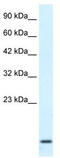 Homeobox A1 antibody, TA337826, Origene, Western Blot image 