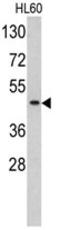 TATA-Box Binding Protein antibody, AP17778PU-N, Origene, Western Blot image 