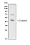 Interleukin 16 antibody, PB9238, Boster Biological Technology, Western Blot image 