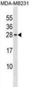 Peptidylprolyl Cis/Trans Isomerase, NIMA-Interacting 4 antibody, abx030395, Abbexa, Western Blot image 