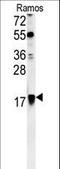 ADP Ribosylation Factor 1 antibody, LS-C156450, Lifespan Biosciences, Western Blot image 