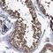 Transmembrane Channel Like 3 antibody, NBP1-86243, Novus Biologicals, Immunohistochemistry paraffin image 