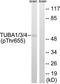 Tubulin Alpha 4a antibody, TA326047, Origene, Western Blot image 