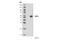 Receptor Interacting Serine/Threonine Kinase 3 antibody, 95702S, Cell Signaling Technology, Western Blot image 