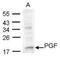 Placental Growth Factor antibody, NBP1-32169, Novus Biologicals, Western Blot image 