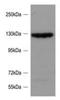 SLIT-ROBO Rho GTPase Activating Protein 2 antibody, orb20597, Biorbyt, Western Blot image 