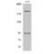 Insulin Like Growth Factor 1 Receptor antibody, LS-C380739, Lifespan Biosciences, Western Blot image 