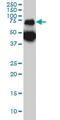 Tripeptidyl Peptidase 1 antibody, ab54685, Abcam, Western Blot image 