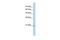 Prostaglandin D2 Synthase antibody, GTX46255, GeneTex, Western Blot image 