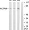 Actinin Alpha 4 antibody, TA311842, Origene, Western Blot image 