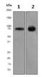 Ectonucleoside Triphosphate Diphosphohydrolase 1 antibody, ab108248, Abcam, Western Blot image 