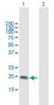 ST6 Beta-Galactoside Alpha-2,6-Sialyltransferase 1 antibody, H00006480-B01P, Novus Biologicals, Western Blot image 