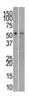 RuvB Like AAA ATPase 2 antibody, AP11721PU-N, Origene, Western Blot image 