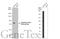 Dopamine Beta-Hydroxylase antibody, GTX101616, GeneTex, Western Blot image 