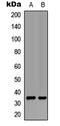 Uncoupling Protein 3 antibody, LS-C358880, Lifespan Biosciences, Western Blot image 