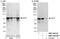 Ecdysoneless Cell Cycle Regulator antibody, NBP1-46214, Novus Biologicals, Western Blot image 