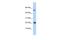 TNF Superfamily Member 12 antibody, PA5-41309, Invitrogen Antibodies, Western Blot image 