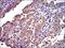 CRK Proto-Oncogene, Adaptor Protein antibody, MA5-15892, Invitrogen Antibodies, Immunohistochemistry paraffin image 