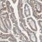 Transmembrane And Immunoglobulin Domain Containing 2 antibody, PA5-52787, Invitrogen Antibodies, Immunohistochemistry paraffin image 