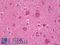 Protein Kinase C Epsilon antibody, LS-B7689, Lifespan Biosciences, Immunohistochemistry frozen image 