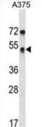 Septin 11 antibody, abx029101, Abbexa, Western Blot image 