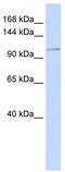 ATPase Plasma Membrane Ca2+ Transporting 3 antibody, TA335276, Origene, Western Blot image 