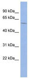 Mitogen-Activated Protein Kinase Kinase Kinase 8 antibody, TA329168, Origene, Western Blot image 