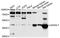 Alpha 1,4-Galactosyltransferase (P Blood Group) antibody, STJ111431, St John