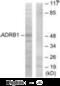 Adrenoceptor Beta 1 antibody, MBS002474, MyBioSource, Western Blot image 