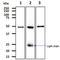 Aldehyde Dehydrogenase 2 Family Member antibody, GTX57696, GeneTex, Western Blot image 